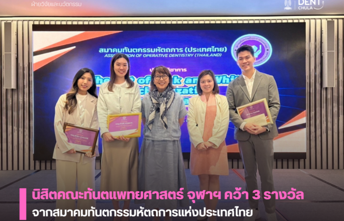 นิสิตคณะทันตแพทยศาสตร์ จุฬาฯ คว้า 3 รางวัล จากสมาคมทันตกรรมหัตถการแห่งประเทศไทย