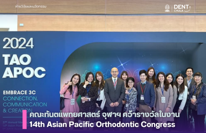 Congratulations to the faculty members of the Department of Orthodontics, Faculty of Dentistry, Chulalongkorn University 🦷✨ for their recognition at the 14th Asian Pacific Orthodontic Congress, held from December 3-5, 2024, at the TaiNEX2 Convention Center in Taipei, Taiwan.