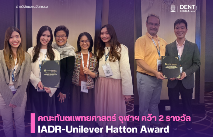 นิสิตคณะทันตแพทยศาสตร์ จุฬาฯ คว้า 2 รางวัล จาก IADR-Unilever Hatton Award 2024