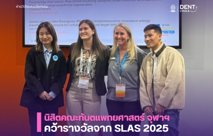 นิสิตคณะทันตแพทยศาสตร์ จุฬาฯ คว้ารางวัล จาก SLAS2025